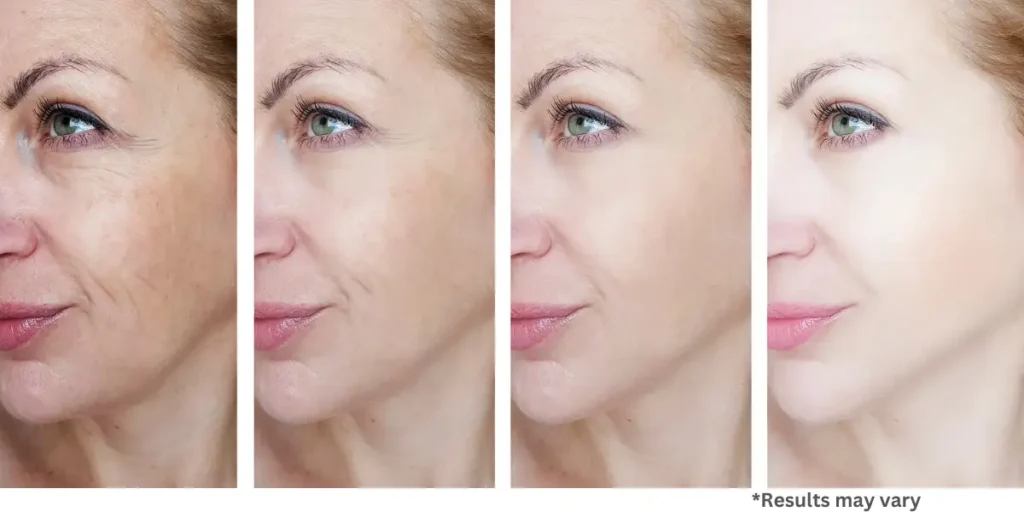 Renovare Pro before/after